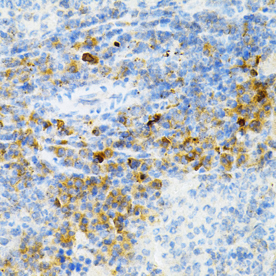 SULT2A1 Antibody in Immunohistochemistry (Paraffin) (IHC (P))