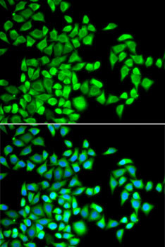 ABH1 Antibody in Immunocytochemistry (ICC/IF)