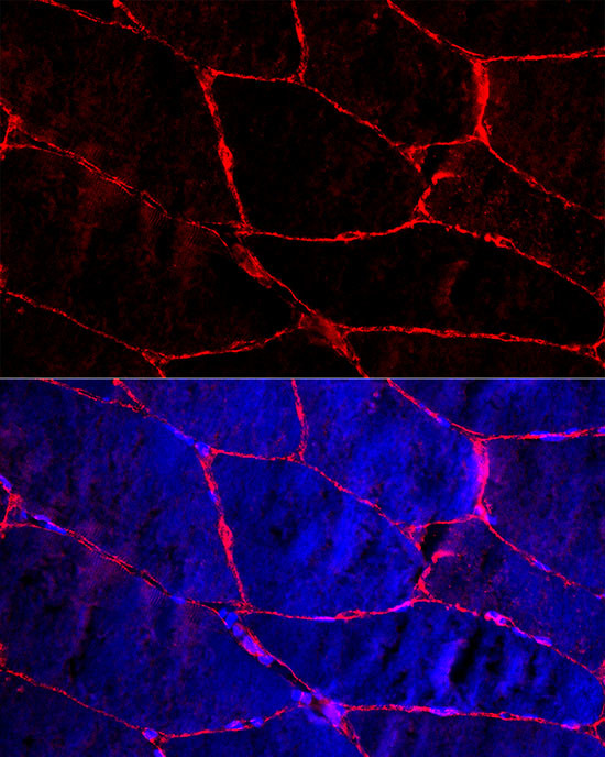 Dystrophin Antibody in Immunocytochemistry (ICC/IF)