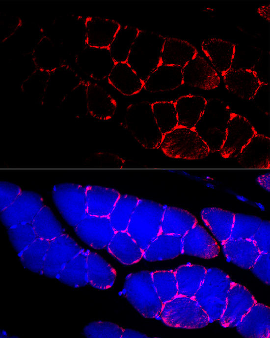 Dystrophin Antibody in Immunocytochemistry (ICC/IF)