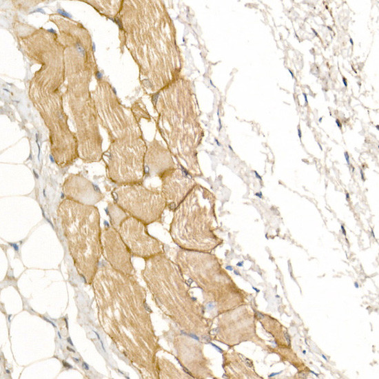 Dystrophin Antibody in Immunohistochemistry (Paraffin) (IHC (P))