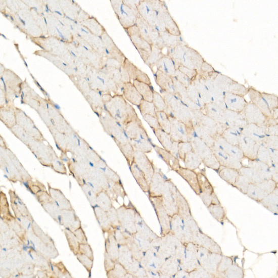 Dystrophin Antibody in Immunohistochemistry (Paraffin) (IHC (P))