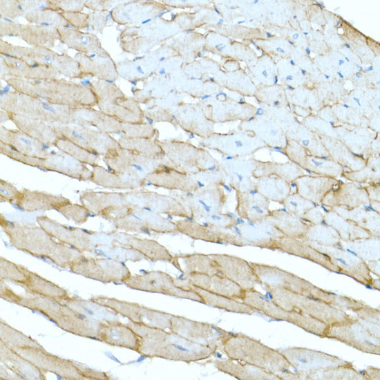 Dystrophin Antibody in Immunohistochemistry (Paraffin) (IHC (P))