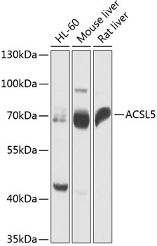 ACSL5 Antibody in Western Blot (WB)