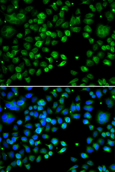 TXNDC5 Antibody in Immunocytochemistry (ICC/IF)