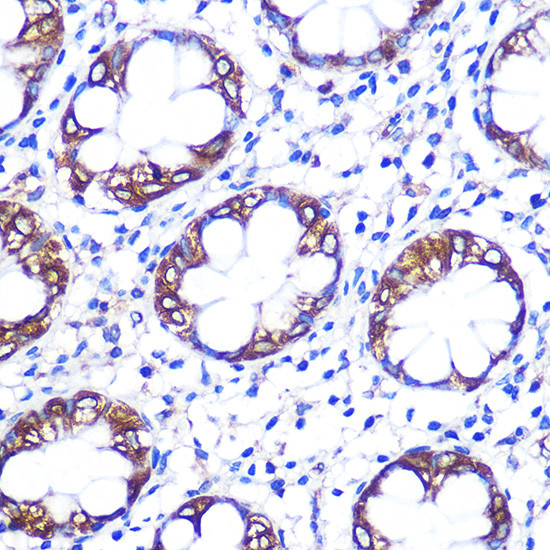 SLC6A4 Antibody in Immunohistochemistry (Paraffin) (IHC (P))