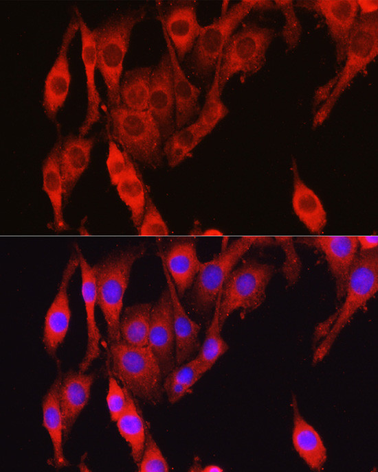 Vinculin Antibody in Immunocytochemistry (ICC/IF)