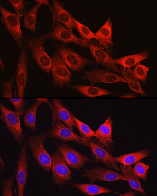 Vinculin Antibody in Immunocytochemistry (ICC/IF)