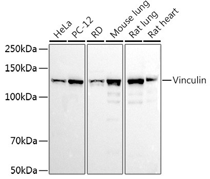 Vinculin Antibody in Western Blot (WB)