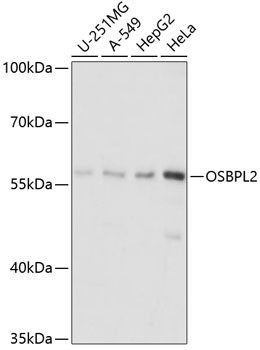 ORP2 Antibody in Western Blot (WB)