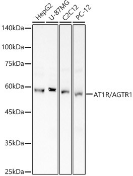 AGTR1 Antibody in Western Blot (WB)