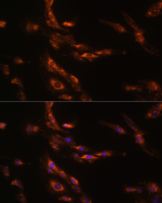 GABRG1 Antibody in Immunocytochemistry (ICC/IF)