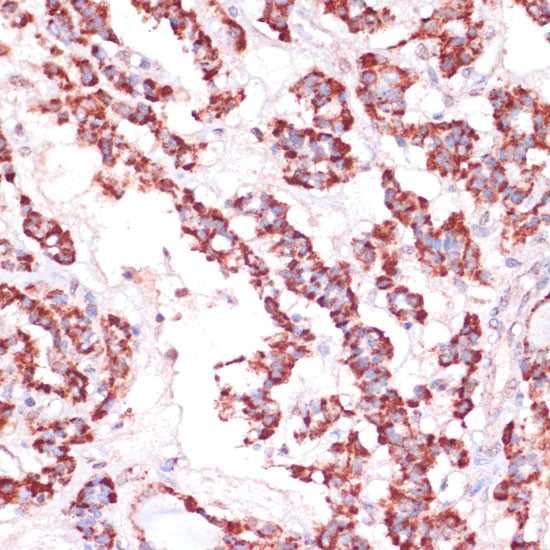 RPL24 Antibody in Immunohistochemistry (Paraffin) (IHC (P))