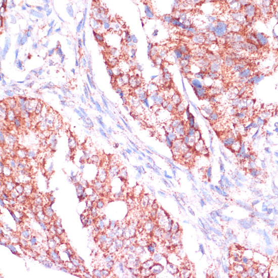 RPL24 Antibody in Immunohistochemistry (Paraffin) (IHC (P))