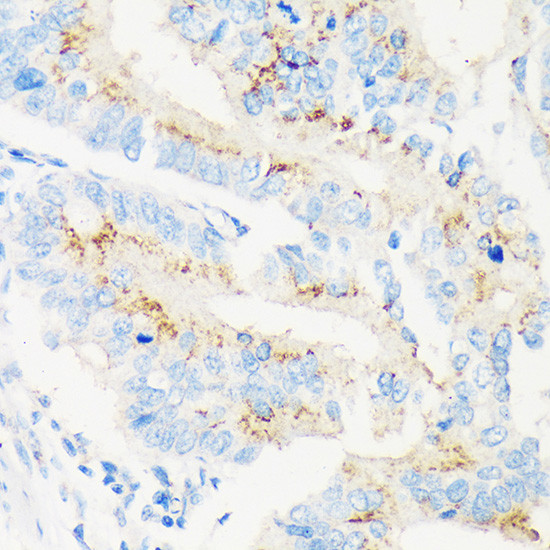 MAN1A2 Antibody in Immunohistochemistry (Paraffin) (IHC (P))