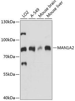 MAN1A2 Antibody in Western Blot (WB)