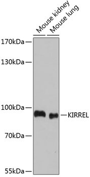 KIRREL Antibody in Western Blot (WB)