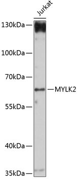 MYLK2 Antibody in Western Blot (WB)