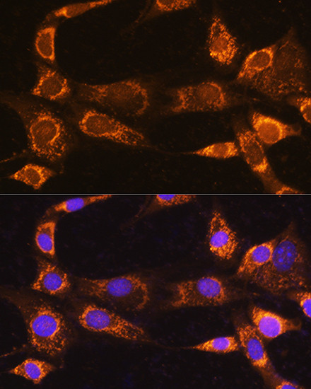 RABL3 Antibody in Immunocytochemistry (ICC/IF)