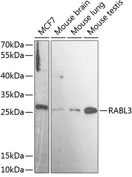 RABL3 Antibody in Western Blot (WB)