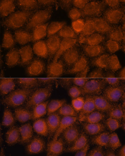 NDUFAF4 Antibody in Immunocytochemistry (ICC/IF)