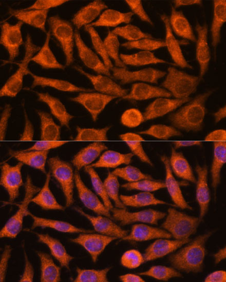 NDUFAF4 Antibody in Immunocytochemistry (ICC/IF)