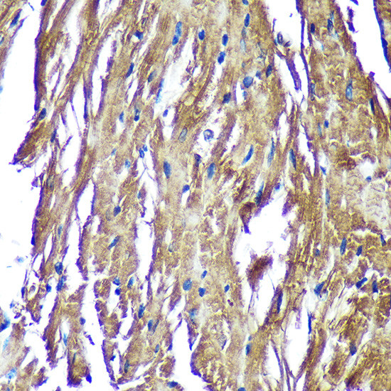 NDUFAF4 Antibody in Immunohistochemistry (Paraffin) (IHC (P))