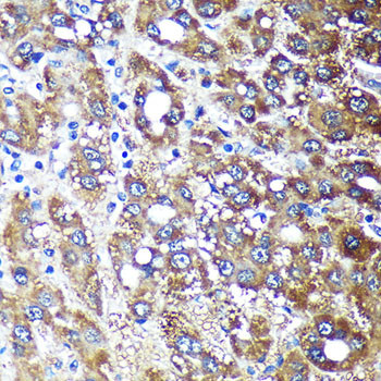 NDUFAF4 Antibody in Immunohistochemistry (Paraffin) (IHC (P))