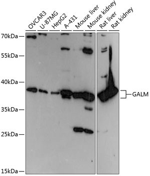 GALM Antibody in Western Blot (WB)