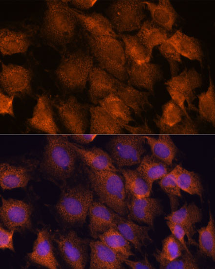 SCRN3 Antibody in Immunocytochemistry (ICC/IF)