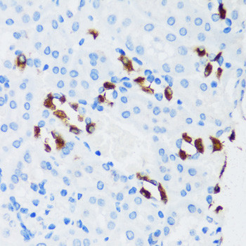 V-ATPase G3 Antibody in Immunohistochemistry (Paraffin) (IHC (P))