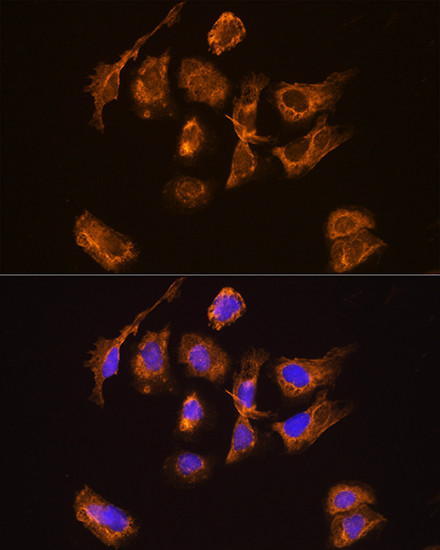 TRH Antibody in Immunocytochemistry (ICC/IF)