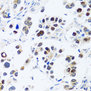 BXDC2 Antibody in Immunohistochemistry (Paraffin) (IHC (P))