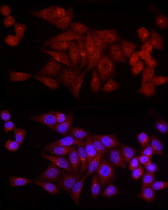 SNRPD1 Antibody in Immunocytochemistry (ICC/IF)