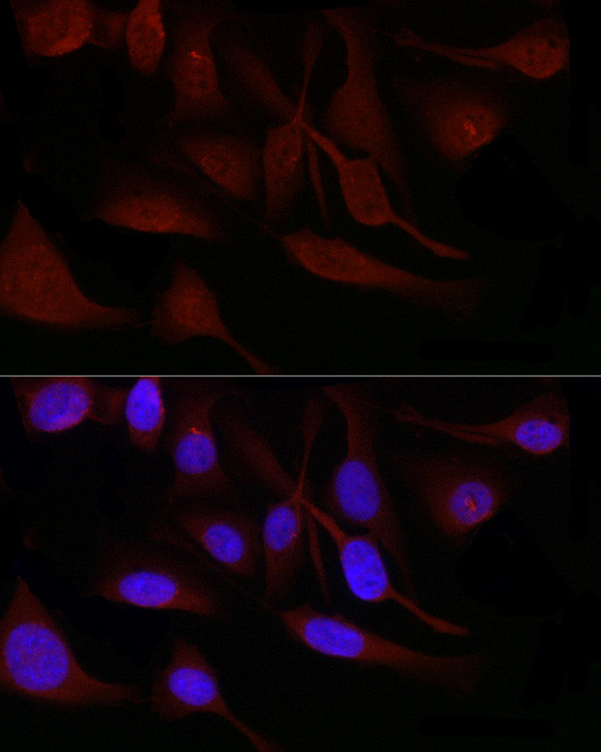 SNRPD1 Antibody in Immunocytochemistry (ICC/IF)