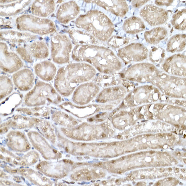 SNRPD1 Antibody in Immunohistochemistry (Paraffin) (IHC (P))