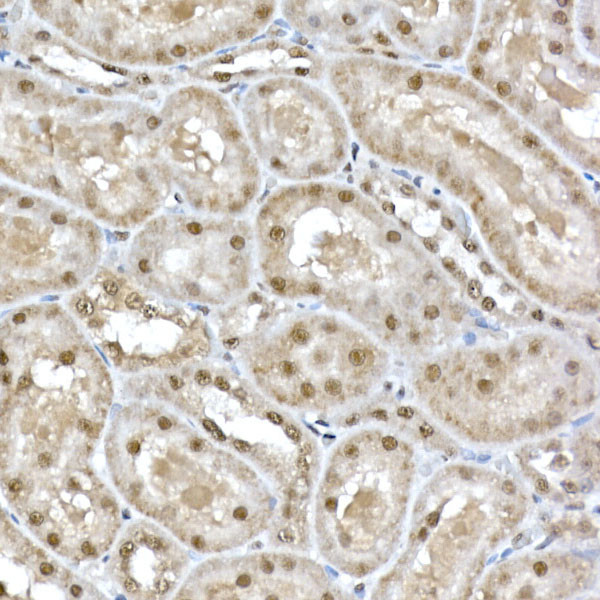 SNRPD1 Antibody in Immunohistochemistry (Paraffin) (IHC (P))