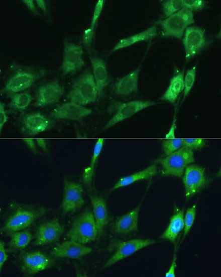 SPARC Antibody in Immunocytochemistry (ICC/IF)