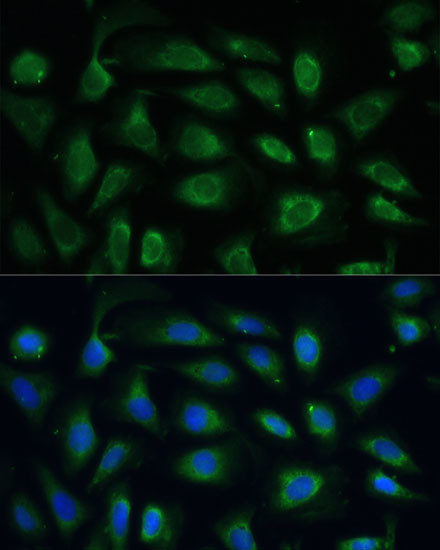 SPARC Antibody in Immunocytochemistry (ICC/IF)