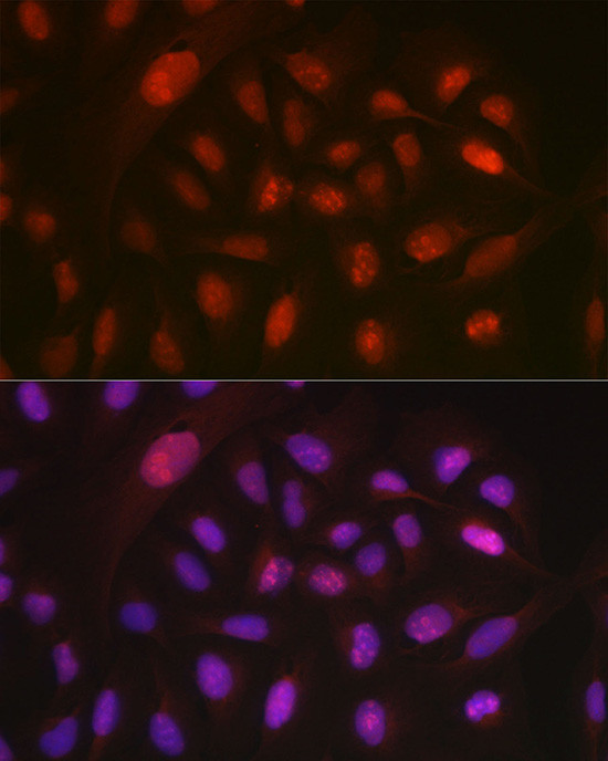 DYNLL1 Antibody in Immunocytochemistry (ICC/IF)