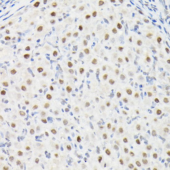 DYNLL1 Antibody in Immunohistochemistry (Paraffin) (IHC (P))