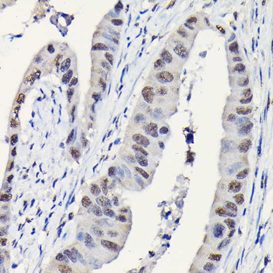 DYNLL1 Antibody in Immunohistochemistry (Paraffin) (IHC (P))