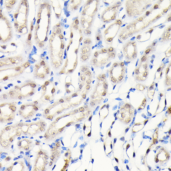 DYNLL1 Antibody in Immunohistochemistry (Paraffin) (IHC (P))