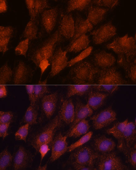 SMYD3 Antibody in Immunocytochemistry (ICC/IF)