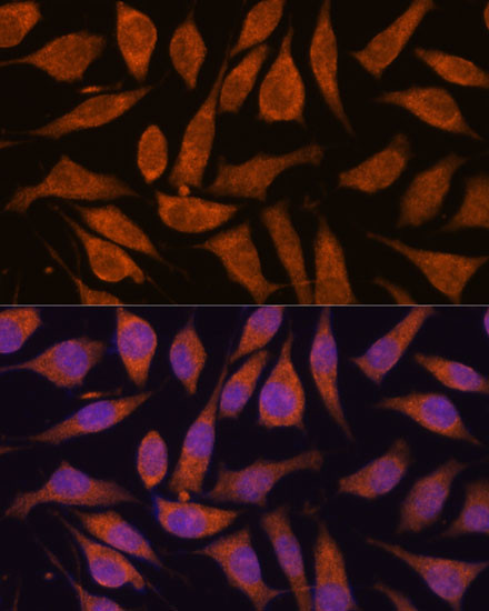 SMYD3 Antibody in Immunocytochemistry (ICC/IF)