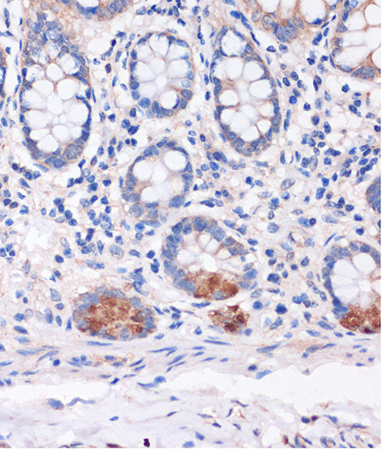 SMYD3 Antibody in Immunohistochemistry (Paraffin) (IHC (P))