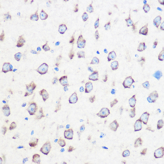 Calmodulin 3 Antibody in Immunohistochemistry (Paraffin) (IHC (P))