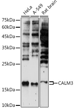 Calmodulin 3 Antibody in Western Blot (WB)