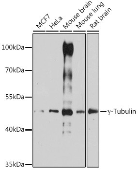 TUBG1 Antibody in Western Blot (WB)