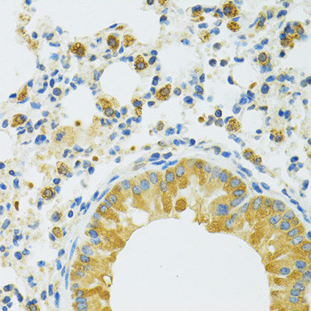 SLC37A4 Antibody in Immunohistochemistry (Paraffin) (IHC (P))